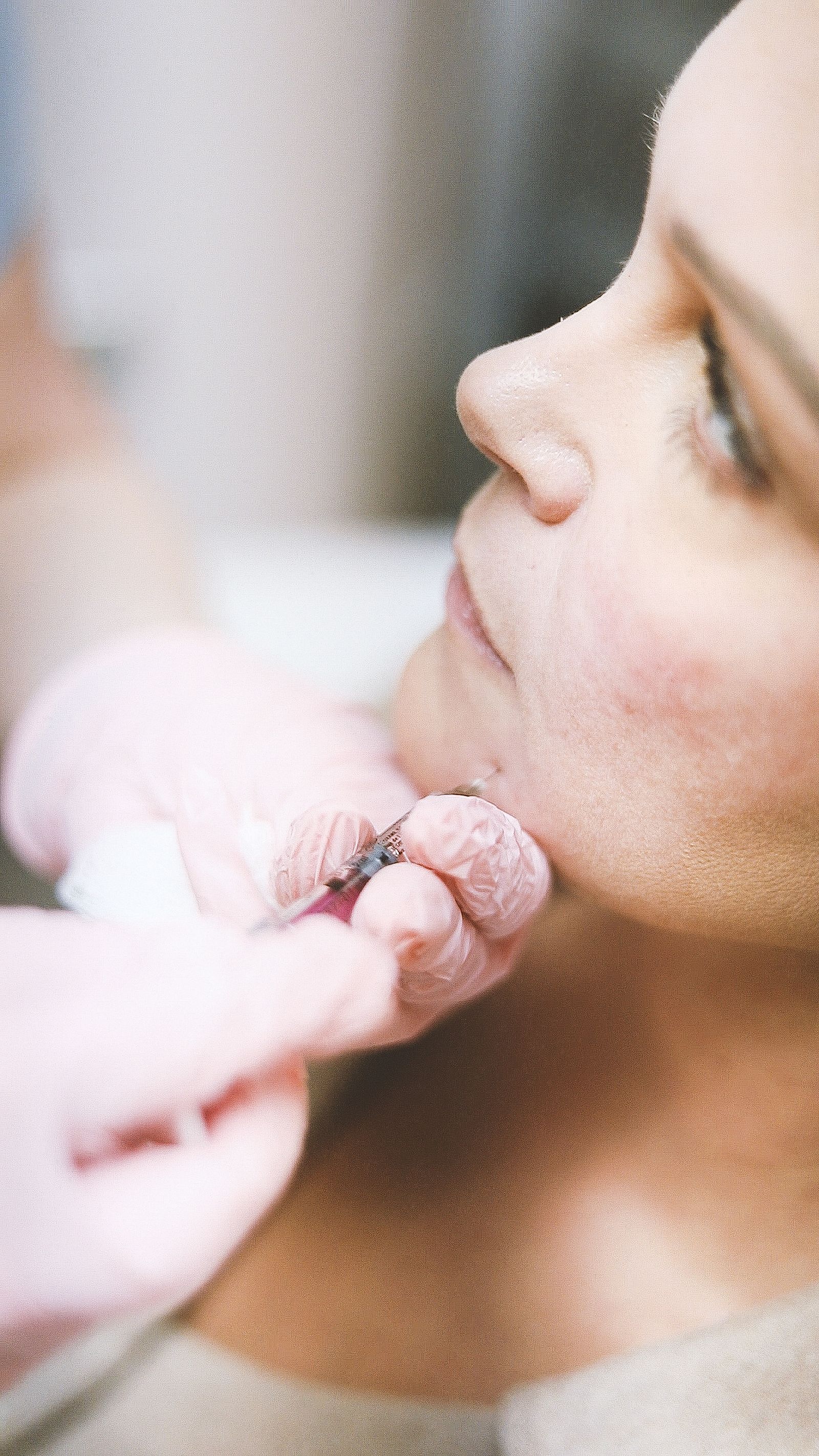 Cheeks, Chin & Jaw Filler