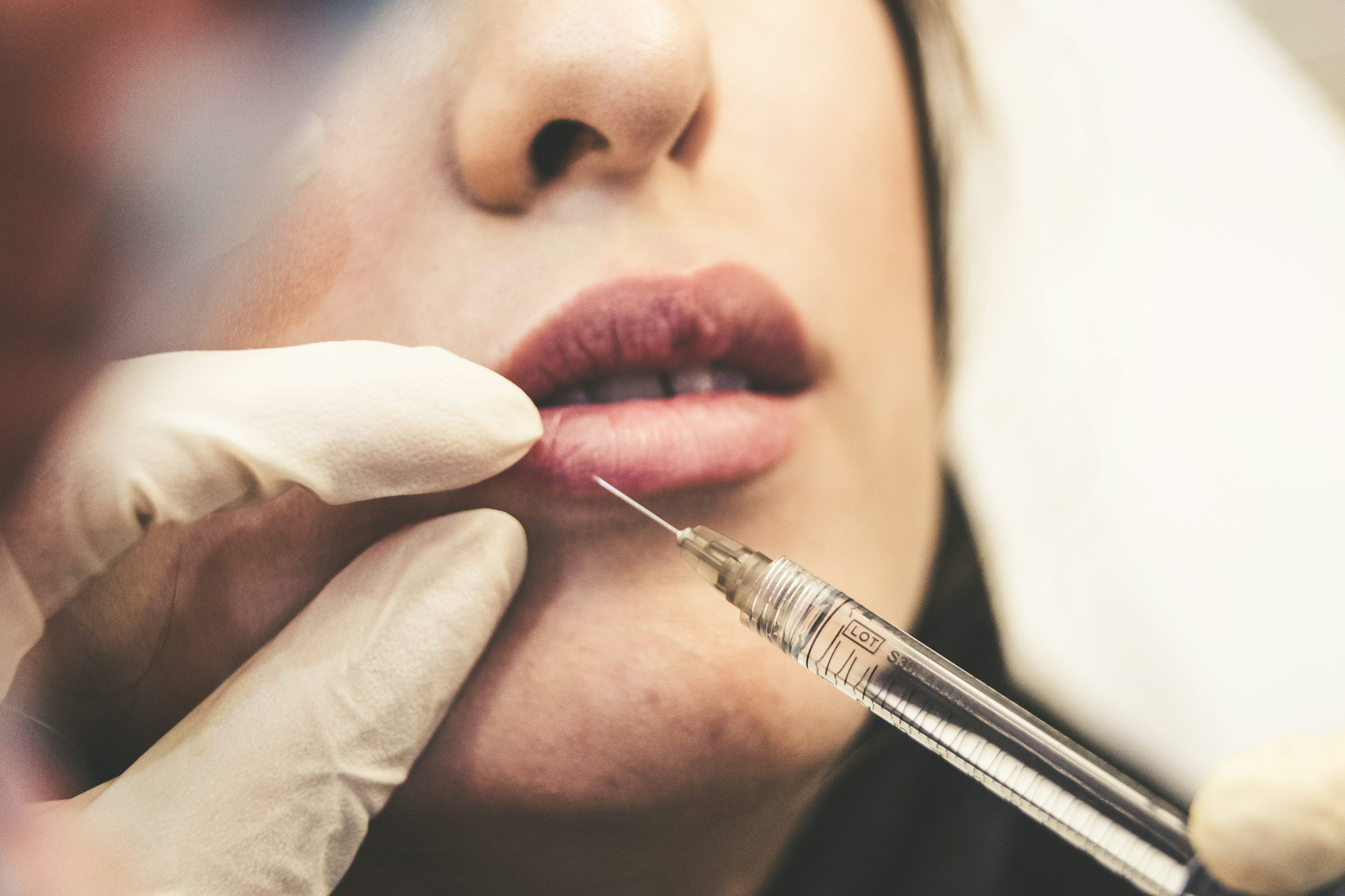 Lip Filler