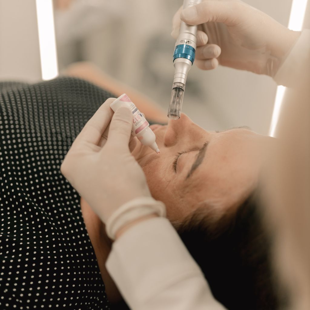 Microneedling Course