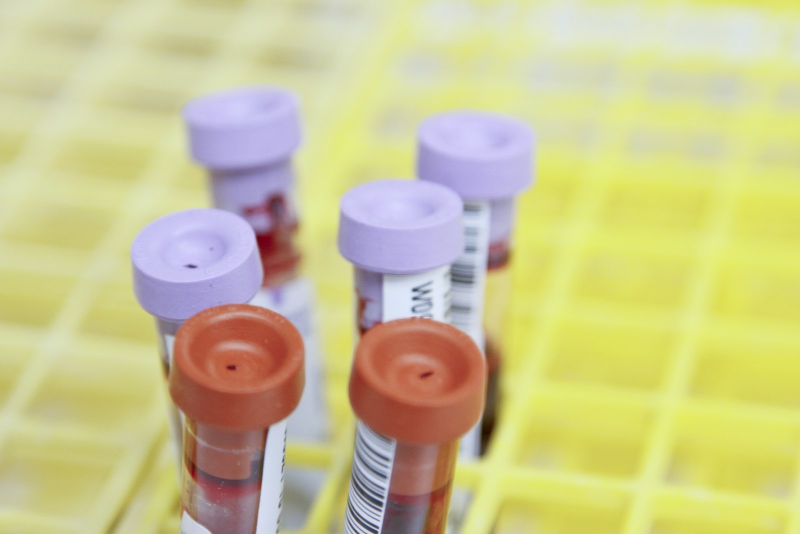 PRP Hair Face and Body with Phlebotomy